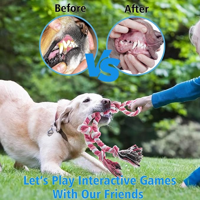 Rope Toy for Dogs, 2 Pack Large Dog Rope Toys for Aggressive Chewers, Heavy Duty Dog Toys for Large Medium Breed, Indestructible Tough Rope Chew Toys Tug of War Dog Toy Teeth Cleaning